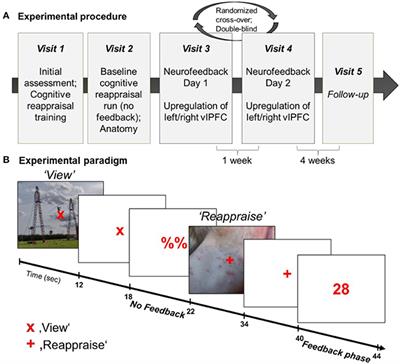 fMRI Neurofeedback-Enhanced Cognitive Reappraisal Training in Depression: A Double-Blind Comparison of Left and Right vlPFC Regulation